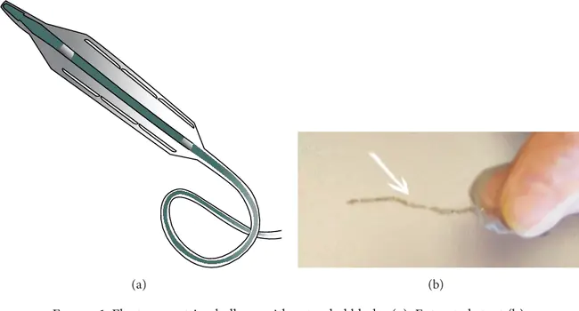 Cutting Balloon Angioplasty : 切割球囊血管成形术