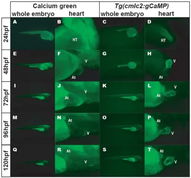 Decidual Cell Reaction : 蜕膜细胞反应