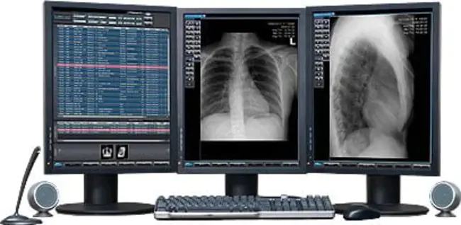 Digital Radiology : 数字放射学