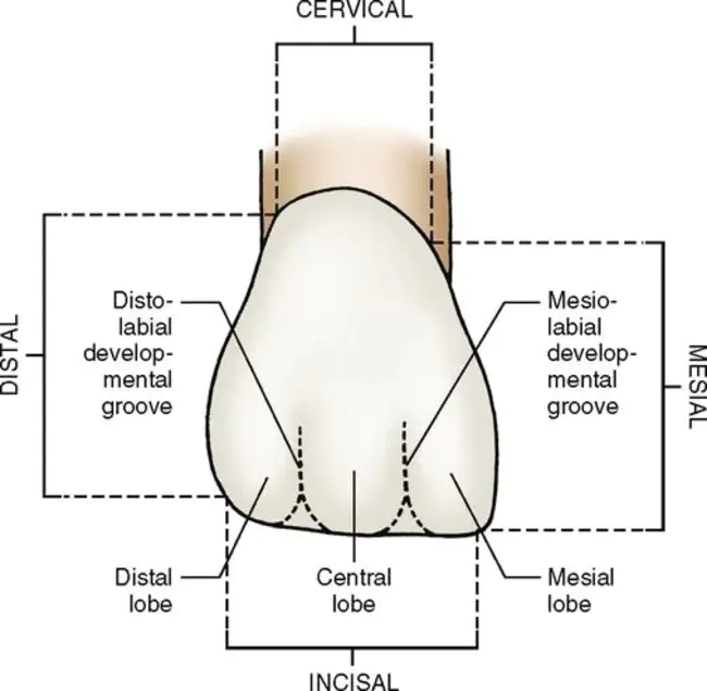 Disto-Incisal : 远中切牙