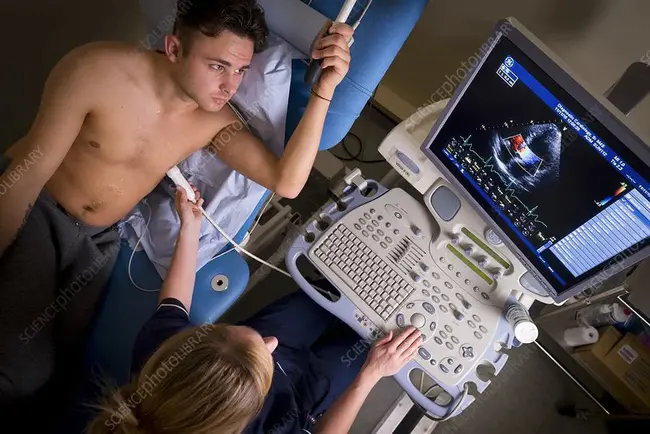 Doppler echocardiography : 多普勒超声心动图
