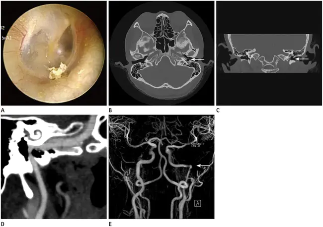 Ears, Nose and Throat : 耳鼻喉