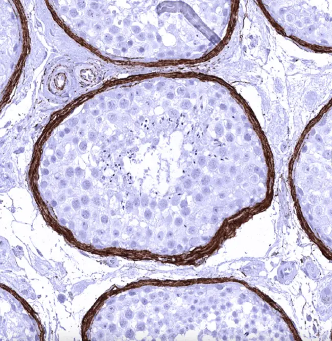 Elastin-Binding Protein : 弹性蛋白结合蛋白