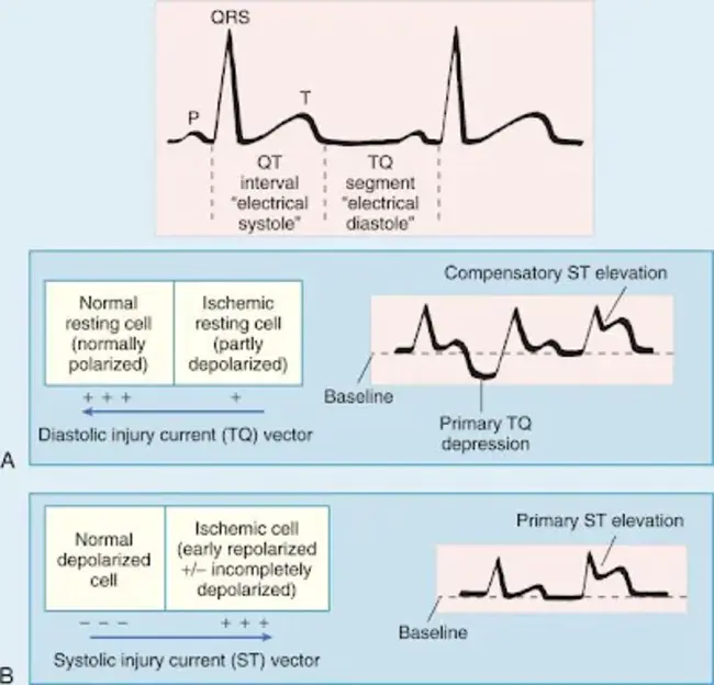 End-Systolic : 收缩末期的