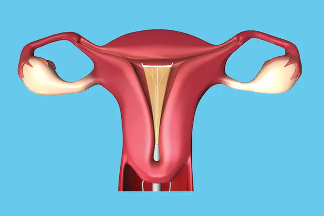 Endometrial Epithelial Cells : 子宫内膜上皮细胞