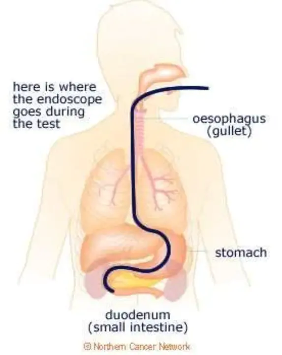 Endoscope-Controlled Microneurosurgery : 内窥镜控制的微神经外科