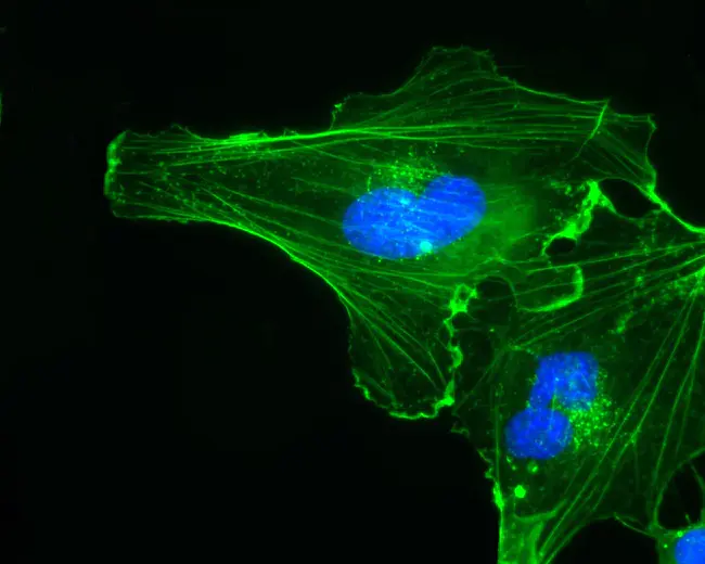 Endothelial Cell : 内皮细胞