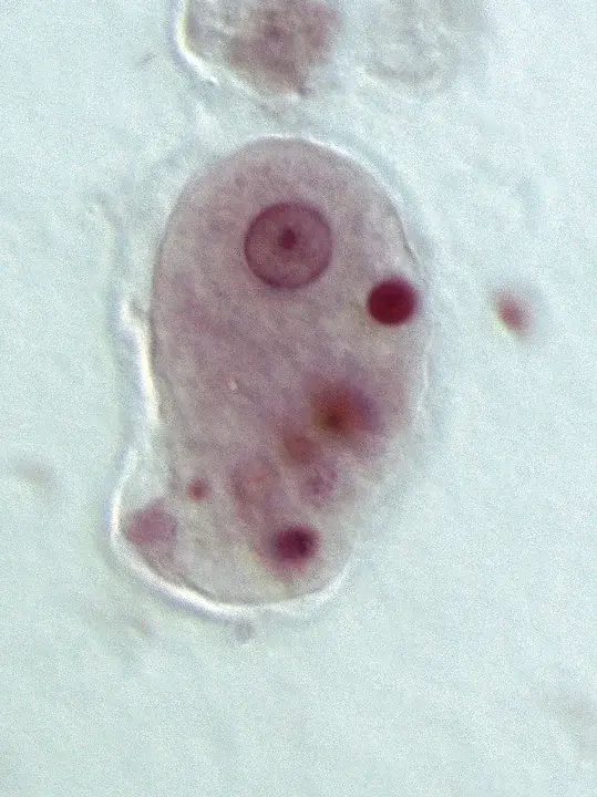 Entamoeba : 内阿米巴