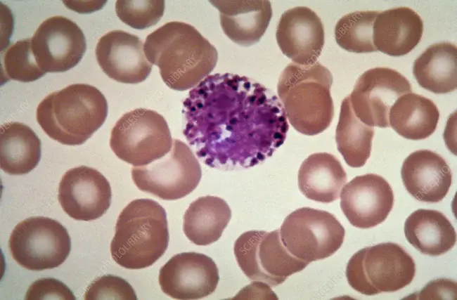 Eosinophil Count : 嗜酸性粒细胞计数