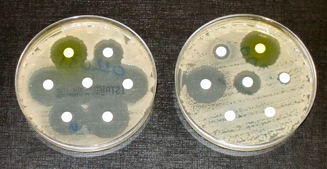 epidemic meticillin-resistant Staphylococcus aureus : 流行性耐甲氧西林金黄色葡萄球菌