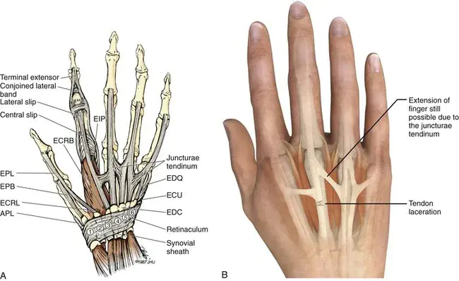 Extensor Indicis : 伸肌指示剂