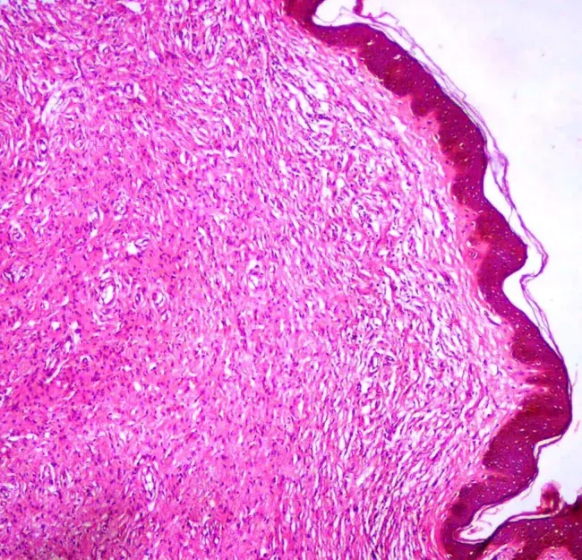 External Cuneate Nucleus : 外楔形核