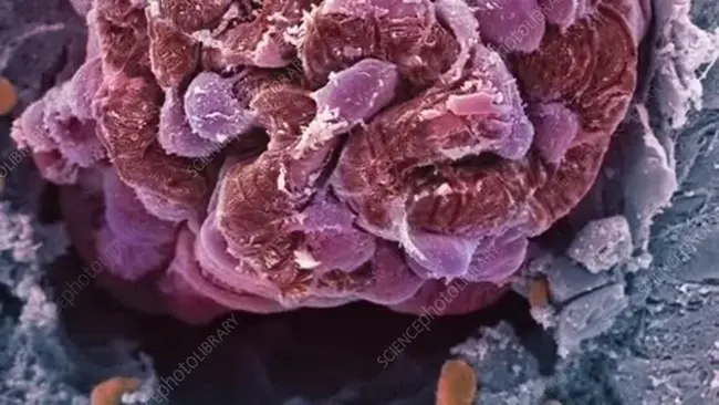 Glomerular Mesangial Cell : 肾小球系膜细胞