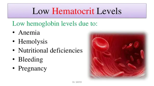 haematocrit : 血细胞比容