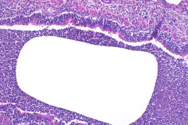 Haematopoietic Stem Cell : 造血干细胞