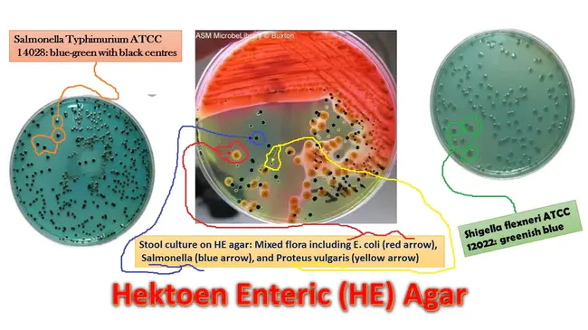 Hektoen enteric Microbiology : Hektoen 肠道微生物学
