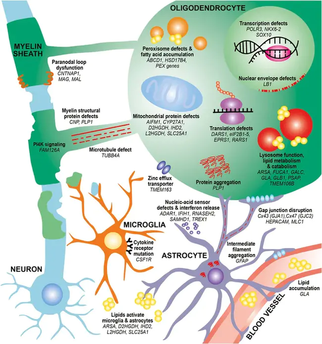 Hereditary Elliptocytosis : 遗传性椭圆细胞增多症