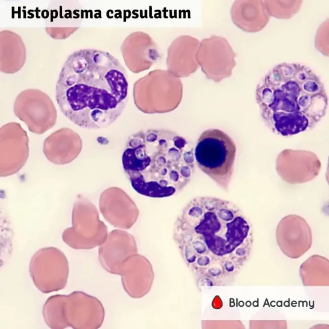 Histoplasma capsulatum : 荚膜组织胞浆菌