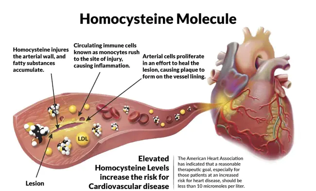 homocysteine : 同型半胱氨酸