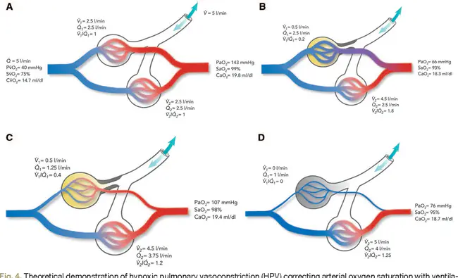 Hypoxic Response : 缺氧反应