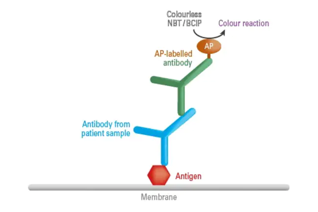 immunoblot : 免疫印迹