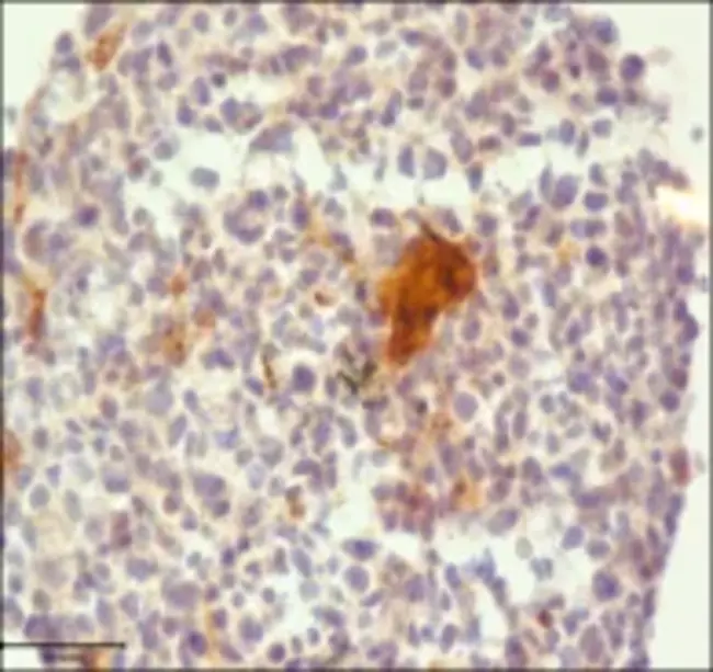 immunoperoxidase : 免疫过氧化物酶