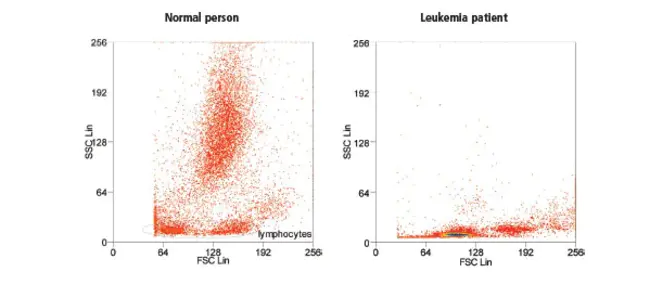 immunophenotype : 免疫表型