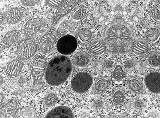 Imprint Cytology : 印记细胞学