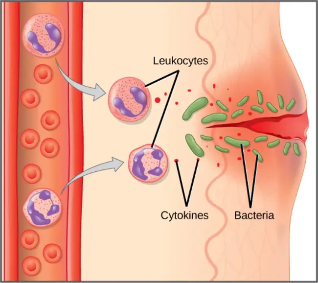 Inflammatory Cells : 炎症细胞