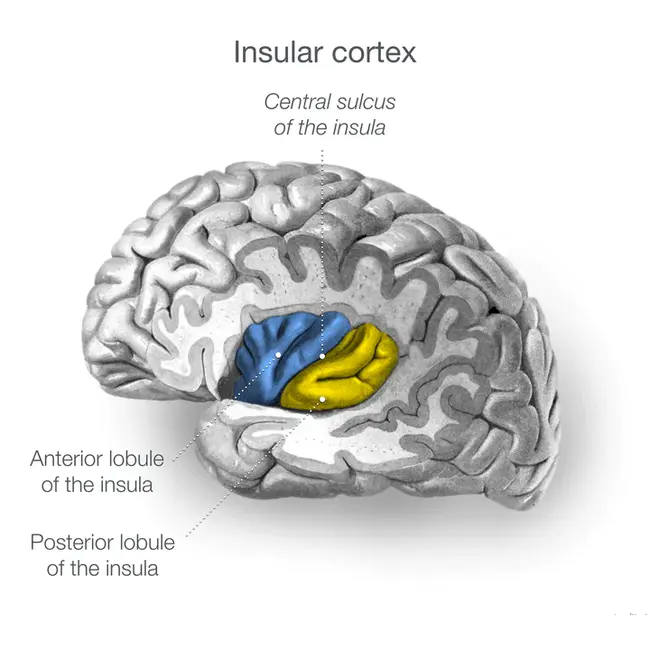 Insular Carcinoma : 岛叶癌