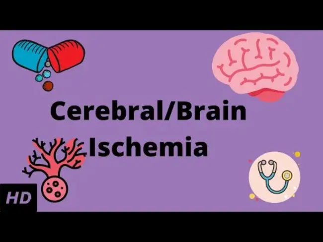Ischaemic Brain Disease : 缺血性脑疾病