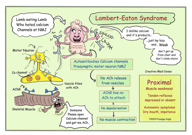 Lambert-Eaton Syndrome : 兰伯特-伊顿综合症