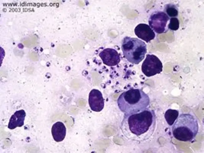 Leishmania donovani : 多诺瓦尼利什曼原虫