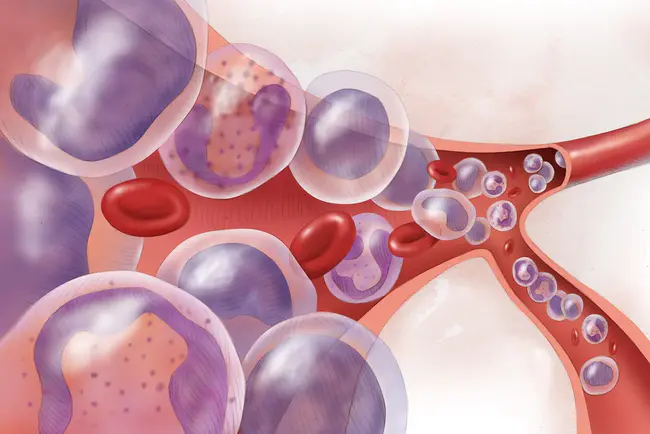 Lymphocytic Infiltration of the Skin : 皮肤淋巴细胞浸润