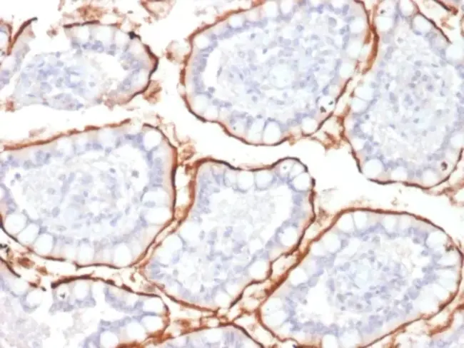 metalloendopeptidase : 金属内肽酶