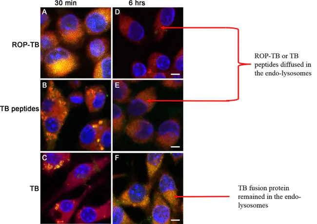 microtubule-associated protein(s) : 微管相关蛋白