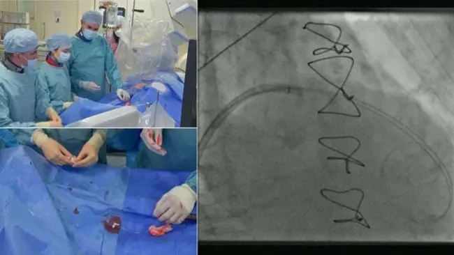 Mitral Disease : 二尖瓣病变