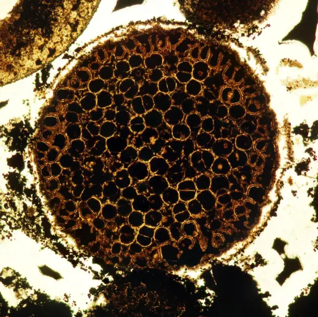 Mixed Cellularity : 混合细胞性