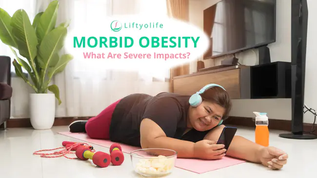 Morbid Obesity : 病态肥胖