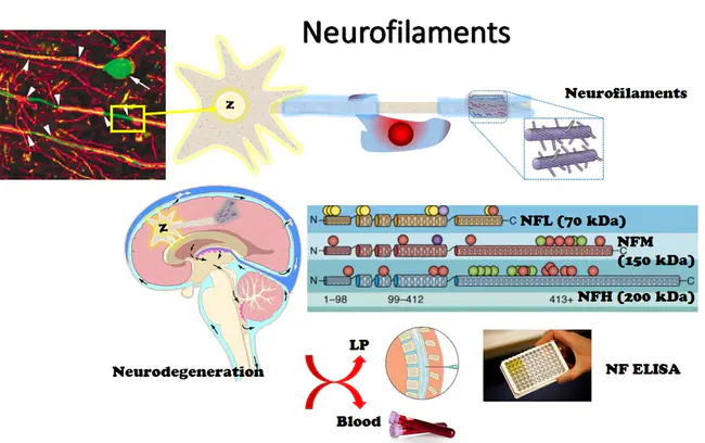 neurofilament : 神经丝