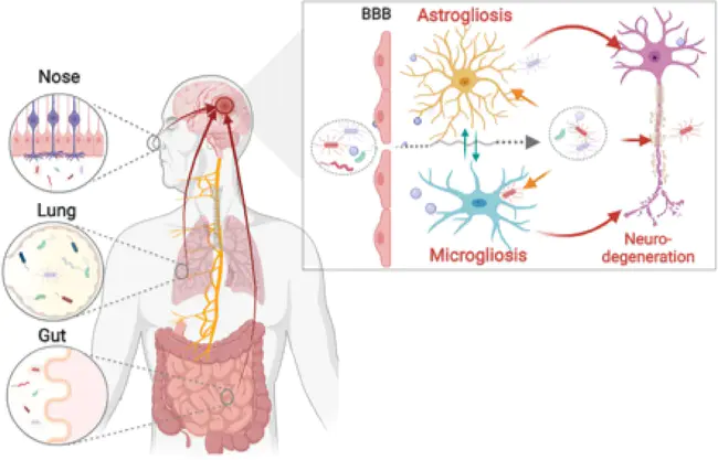 Neurogenic Inflammation : 神经源性炎症