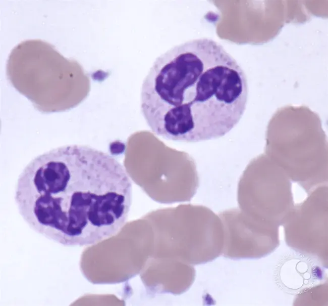 Neutrophil Chemotactic Activity : 中性粒细胞趋化活性