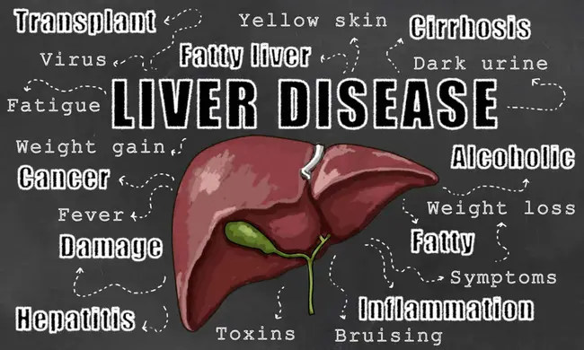 Non-Alcoholic Cirrhosis : 非酒精性肝硬化