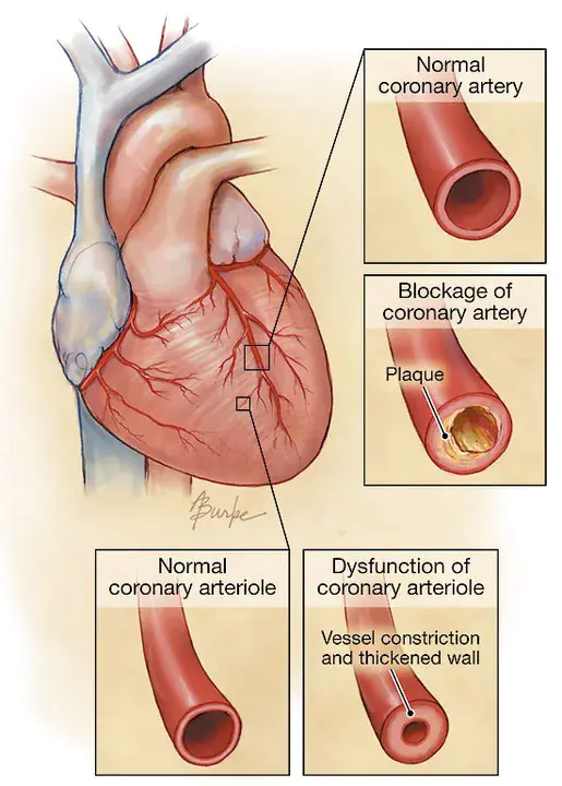 Non-Coronary Leaflet : 非冠状动脉小叶