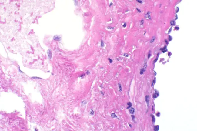 Non-Parenchymal Cells : 非实质细胞