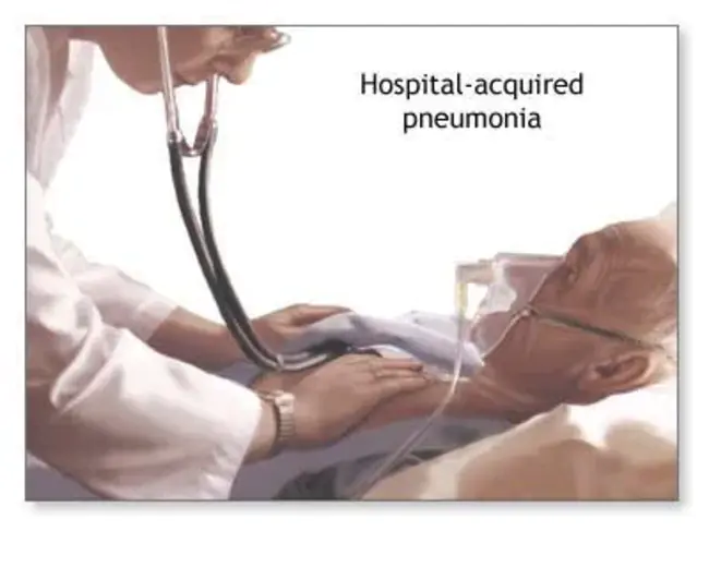 Nosocomial Pneumonia : 医院肺炎