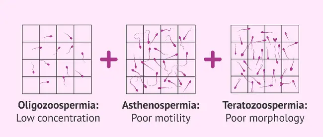 oligoasthenoteratozoospermia : 少弱弱精子症