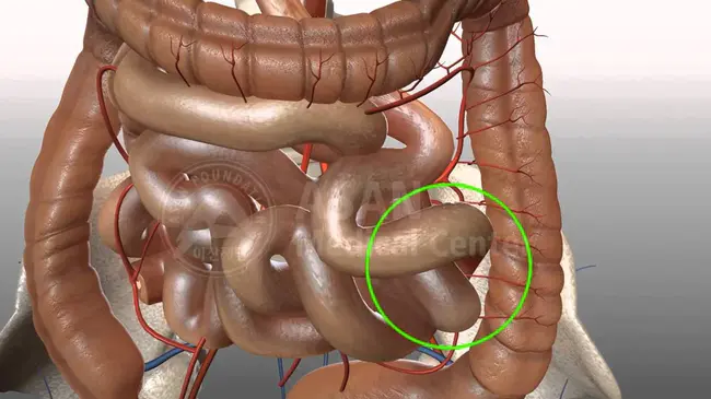 Pancreas-Sparing Duodenectomy : 保留胰十二指肠切除术