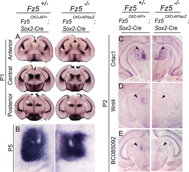 parafascicular : 束旁的