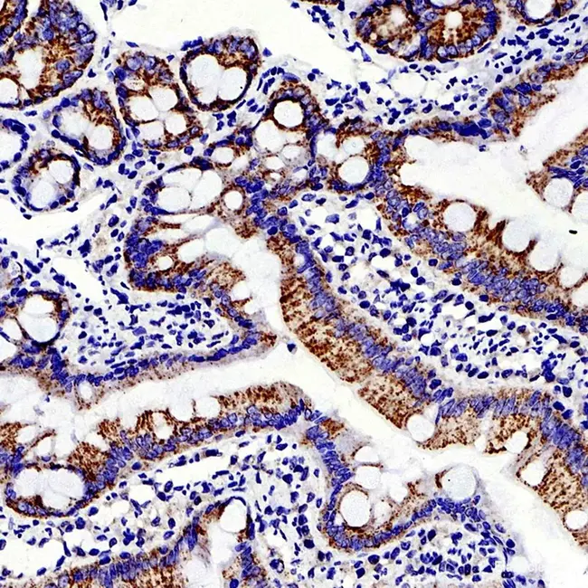 pegylated immunoliposome : 聚乙二醇免疫脂质体